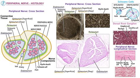 Histology: Peripheral Nerve Histology | Draw It to Know It