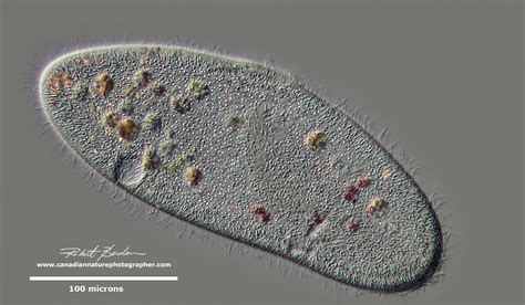 Ciliates Under Microscope