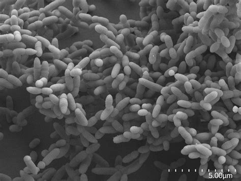 Archaea: The Strange Biology You’ve Never Heard Of | by Bernie E ...