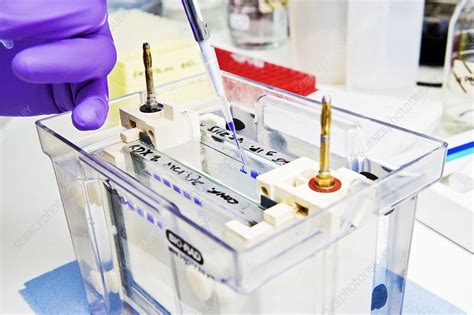 Gel electrophoresis - Stock Image - C001/8662 - Science Photo Library