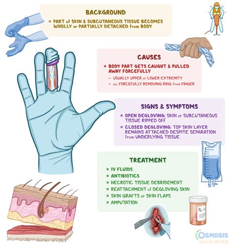 Degloving: What Is It, Causes, Clinical Presentation, and More | Osmosis