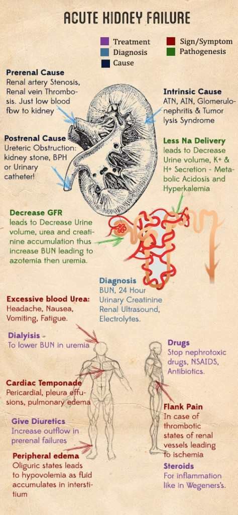 Understanding Acute Renal Failure: Causes, Symptoms, And Treatment ...