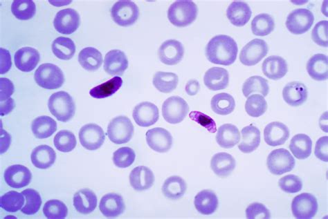 Plasmodium falciparum - Wikipedia