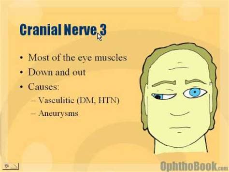 Neuro - Cranial Nerve 3 Palsy - YouTube