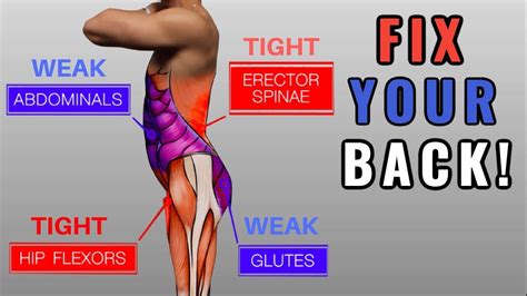 Fix Anterior Pelvic Tilt in 10 Minutes/Day (Daily Exercise Routine)