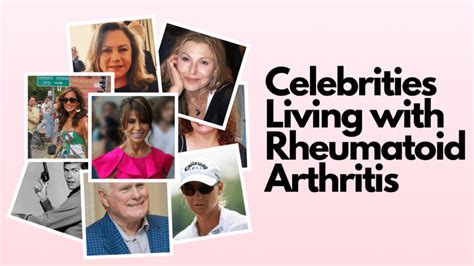 Celebrities Living with Rheumatoid Arthritis - Walkin Lab