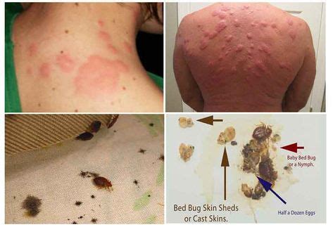 60 Bed Bugs ideas | bed bugs, bugs, rid of bed bugs