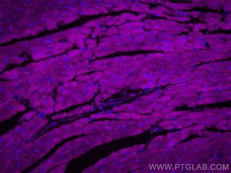 RYR2 antibody (CL647-27587) | Proteintech