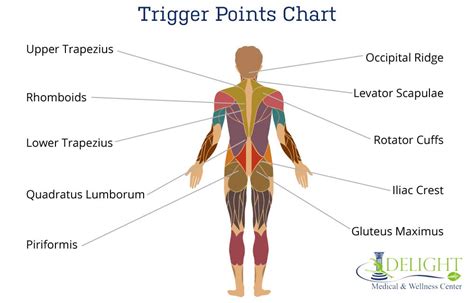 Trapezius Trigger Points Referred Pain