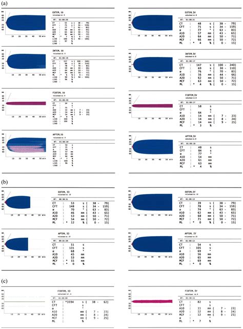 IO and IV ROTEM test results in healthy volunteers: whereas one probe ...