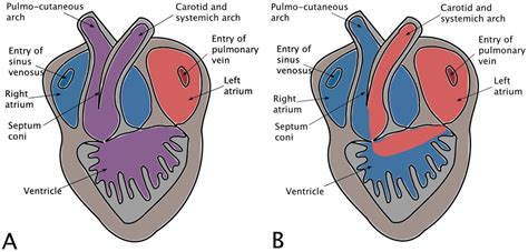 Conus Arteriosus Heart