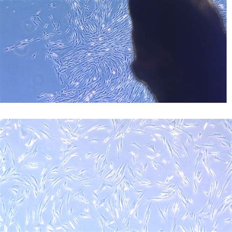 (A) Fibroblast cell migration from the explant human gingival ...