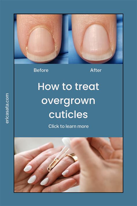 Nail Care Tips, Manicure Tips, Diy Nails, Cuticle Care, Nail Cuticle ...