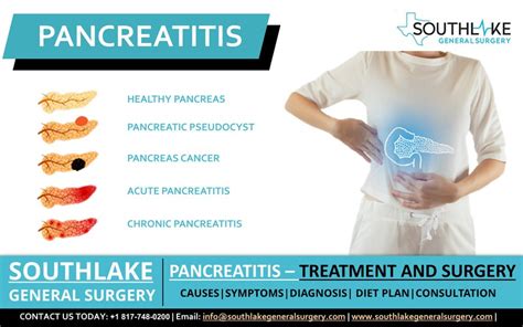 Pancreatitis Treatment and Surgery - Southlake General Surgery