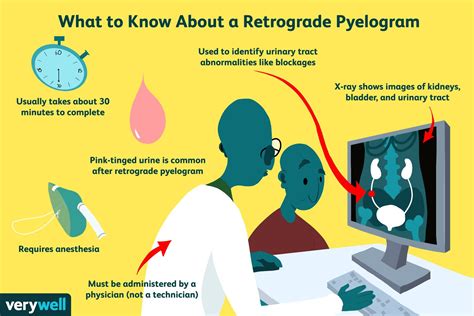 Retrograde Pyelogram: Procedure, Side Effects, Results