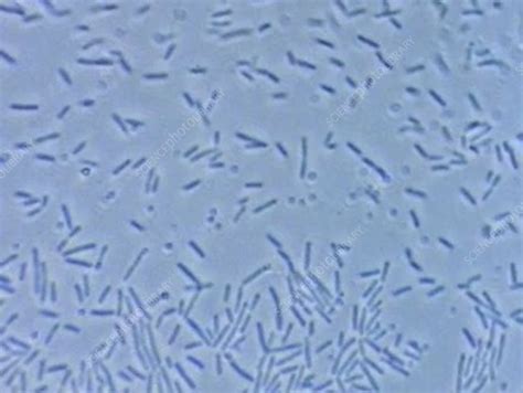 [最も選択された] e coli microscope 284026-E coli under microscope 1000x