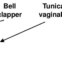 (PDF) Pitfall in Interpretation of MR Imaging of the Bladder