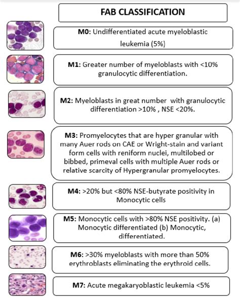 Genomic Classification And Prognosis In Acute Myeloid Leukemia Nejm ...