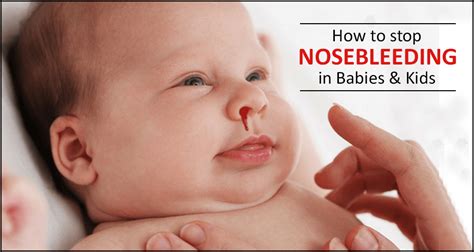 home remedies for nose bleeding in babies