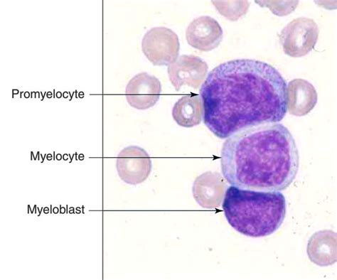 Promyelocyte