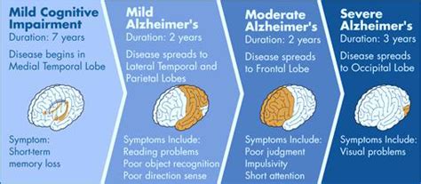 Alzheimer S Stages