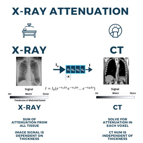 Attenuation Of X Ray Beam - The Best Picture Of Beam