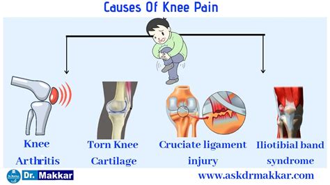 Knee pain Homeopathic treatment Right knee Left Knee by Dr Makkar