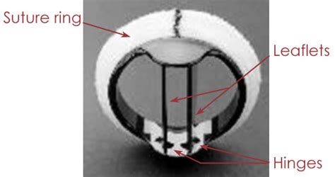 Mechanical Valves