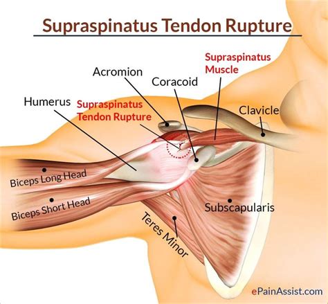 Diagram Of Shoulder Tendons Muscles Ligaments And Tendons Of The Human ...