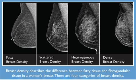 How Does Aging Change Your Breast Density? - Wake Radiology