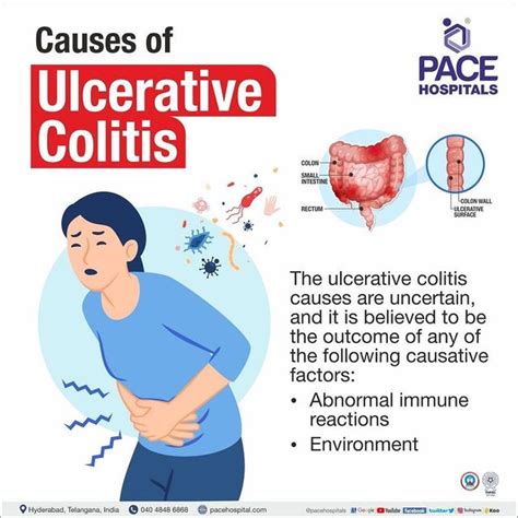 Ulcerative Colitis Symptoms