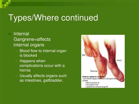 PPT - Gangrene PowerPoint Presentation, free download - ID:1442641