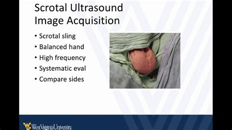 M4 Surgical Skills 2021 POCUS for Testicular Torsion - YouTube