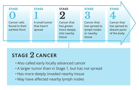 What Is Stage 2 Cancer and How Is It Treated? | City of Hope