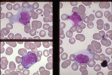 Monocytes And Lymphocytes