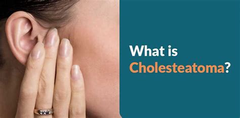 What is Cholesteatoma? Symptoms, Causes and Treatments | BHH