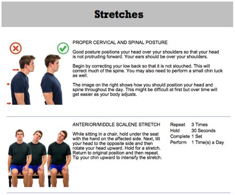 Oakville Thoracic Outlet Syndrome Treatment – Shockwave