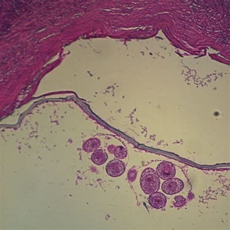 Echinococcus granulosus Hydatid Cyst, sec. Microscope Slide | Carolina.com