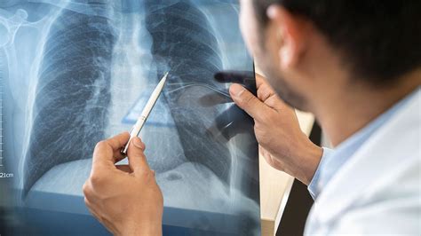 Respiratory (Pulmonary) Medicine - Related Conditions | Parkway East ...