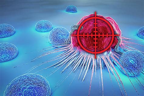 Stereotactic Body Radiation Therapy Sbrt For Lung Cancer - CancerWalls