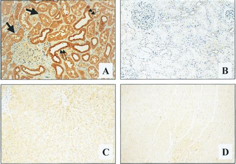 Immunolocalization of 1 -hydroxylase in positive and negative control ...