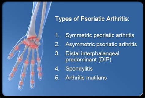 Symptoms, Causes, and Treatment of Psoriatic Arthritis - HealthProAdvice