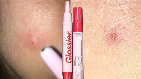 New glossier the zit stick review – Artofit