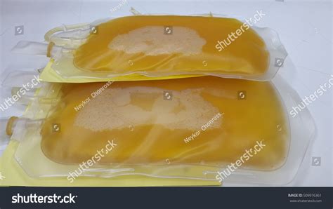 Fresh Frozen Plasma Stock Photo 509976361 : Shutterstock