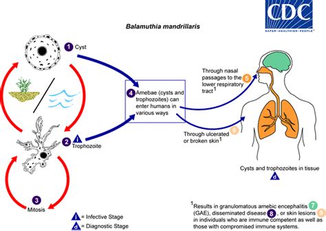 Balamuthia mandrillaris - wikidoc