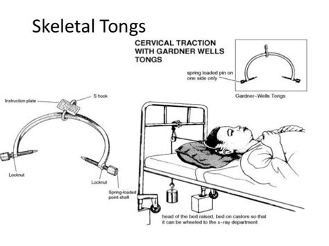 Traction