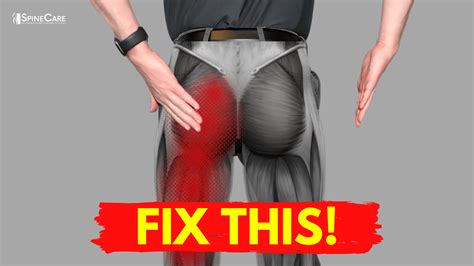 The QUICKEST Way to Get Sciatic Leg Pain Relief | SpineCare | Dr. Rowe