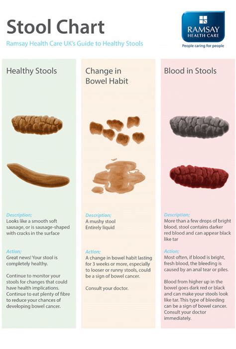 Bowel cancer symptoms: Blood in stool and red poo could be signs ...