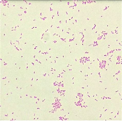 Gram Negative Coccobacilli Chart