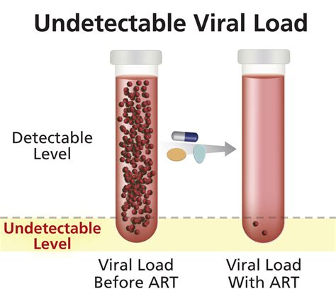 Undetectable Viral Load | NIH